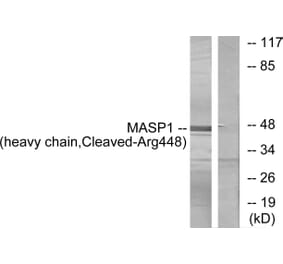 Western Blot - Anti-MASP1 (heavy chain,cleaved Arg448) Antibody (L0238) - Antibodies.com