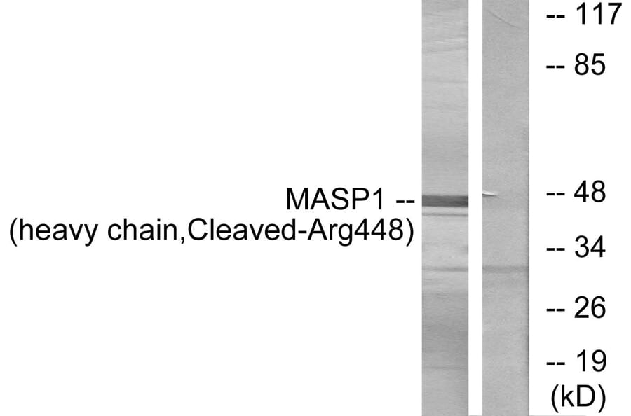 Western Blot - Anti-MASP1 (heavy chain,cleaved Arg448) Antibody (L0238) - Antibodies.com