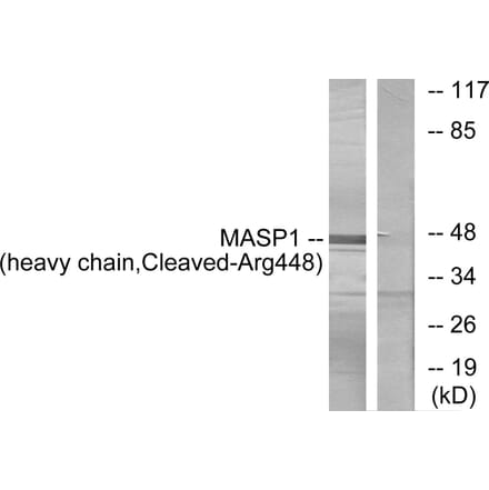 Western Blot - Anti-MASP1 (heavy chain,cleaved Arg448) Antibody (L0238) - Antibodies.com