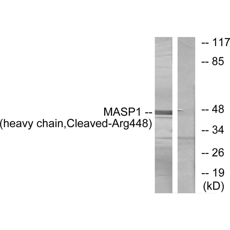 Western Blot - Anti-MASP1 (heavy chain,cleaved Arg448) Antibody (L0238) - Antibodies.com
