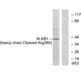 Western Blot - Anti-KLKB1 (heavy chain,cleaved Arg390) Antibody (L0367) - Antibodies.com
