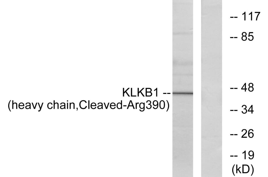 Western Blot - Anti-KLKB1 (heavy chain,cleaved Arg390) Antibody (L0367) - Antibodies.com