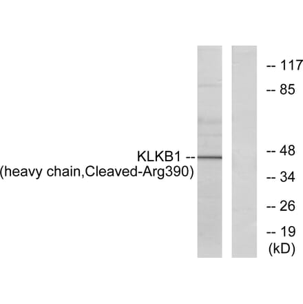 Western Blot - Anti-KLKB1 (heavy chain,cleaved Arg390) Antibody (L0367) - Antibodies.com