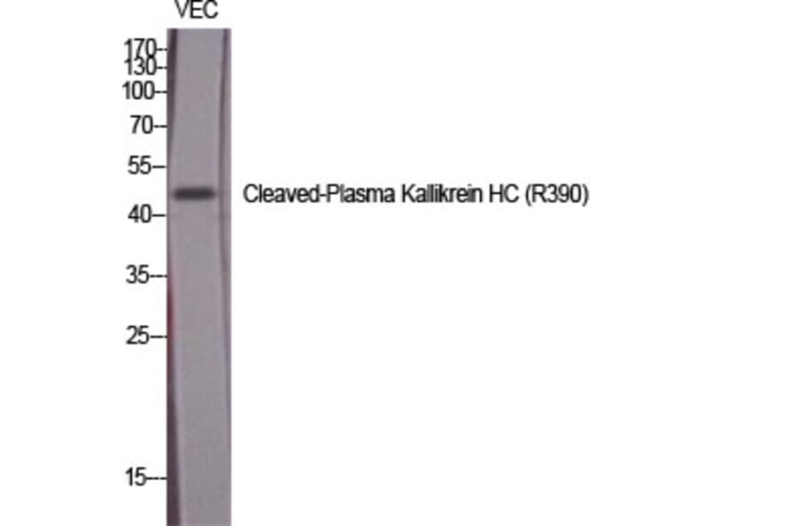 Western Blot - Anti-KLKB1 (heavy chain,cleaved Arg390) Antibody (L0367) - Antibodies.com