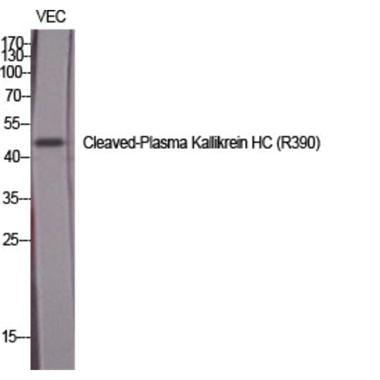 Western Blot - Anti-KLKB1 (heavy chain,cleaved Arg390) Antibody (L0367) - Antibodies.com