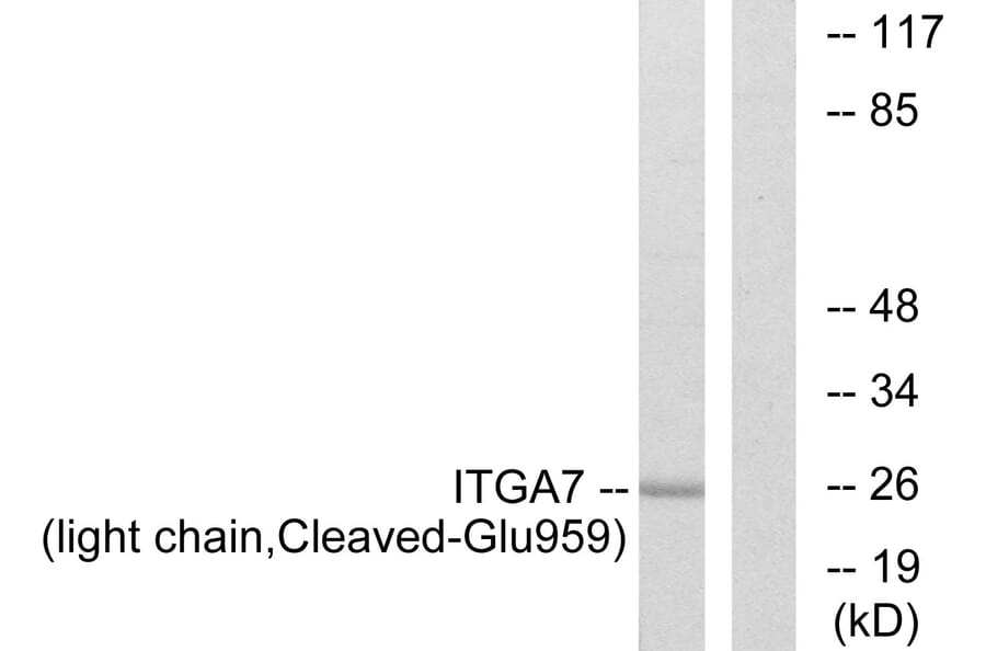 Western Blot - Anti-ITGA7 (light chain,cleaved Glu959) Antibody (L0285) - Antibodies.com