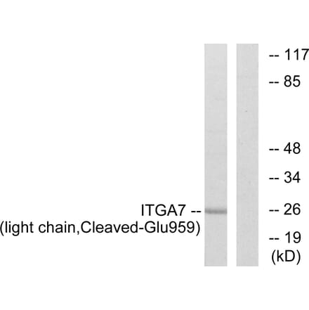 Western Blot - Anti-ITGA7 (light chain,cleaved Glu959) Antibody (L0285) - Antibodies.com