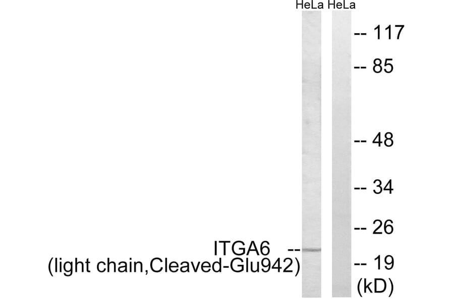 Western Blot - Anti-ITGA6 (light chain,cleaved Glu942) Antibody (L0282) - Antibodies.com