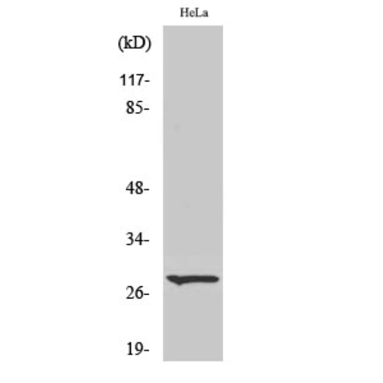 Western Blot - Anti-ITGA6 (light chain,cleaved Glu942) Antibody (L0282) - Antibodies.com