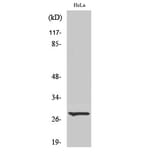 Western Blot - Anti-ITGA6 (light chain,cleaved Glu942) Antibody (L0282) - Antibodies.com