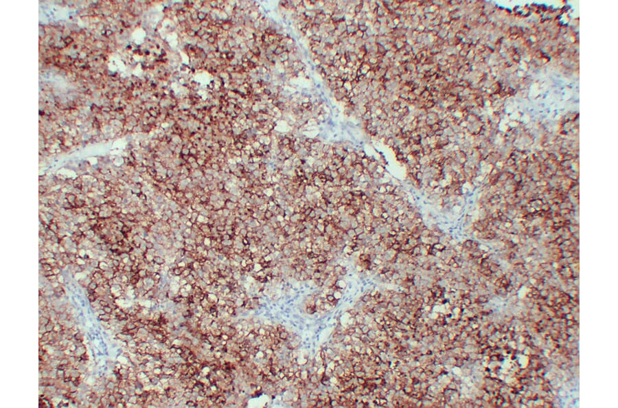 Immunohistochemistry - Anti-Placental Alkaline Phosphatase Antibody (V0112) - Antibodies.com