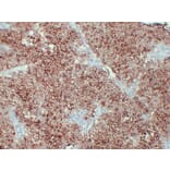 Immunohistochemistry - Anti-Placental Alkaline Phosphatase Antibody (V0112) - Antibodies.com