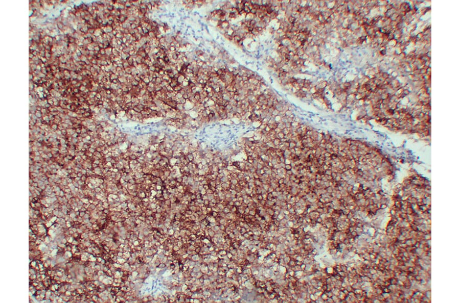 Immunohistochemistry - Anti-Placental Alkaline Phosphatase Antibody (V0112) - Antibodies.com