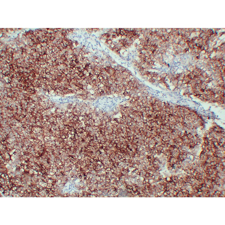 Immunohistochemistry - Anti-Placental Alkaline Phosphatase Antibody (V0112) - Antibodies.com