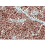 Immunohistochemistry - Anti-Placental Alkaline Phosphatase Antibody (V0112) - Antibodies.com