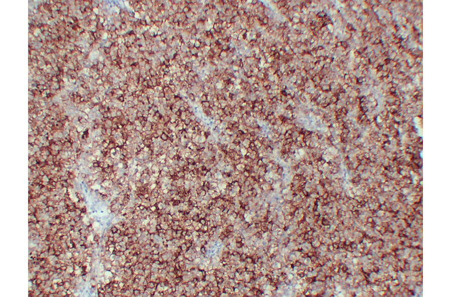 Immunohistochemistry - Anti-Placental Alkaline Phosphatase Antibody (V0112) - Antibodies.com