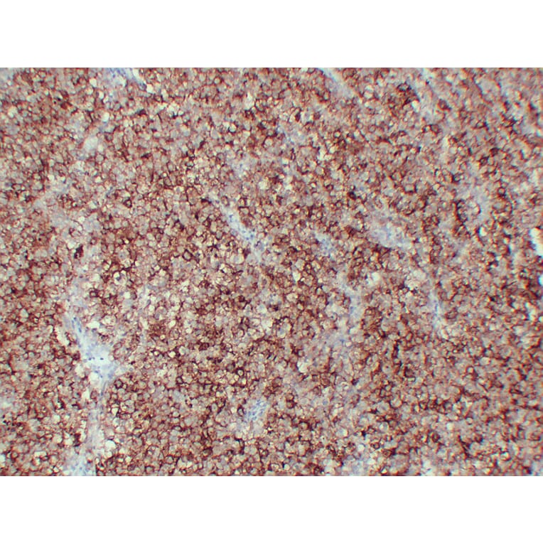 Immunohistochemistry - Anti-Placental Alkaline Phosphatase Antibody (V0112) - Antibodies.com