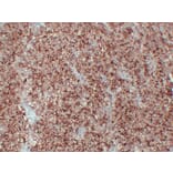 Immunohistochemistry - Anti-Placental Alkaline Phosphatase Antibody (V0112) - Antibodies.com