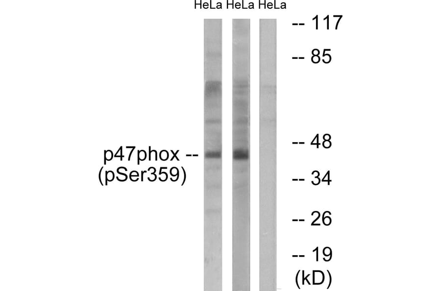 Western Blot - Anti-p47 phox (phospho Ser359) Antibody (A1172) - Antibodies.com