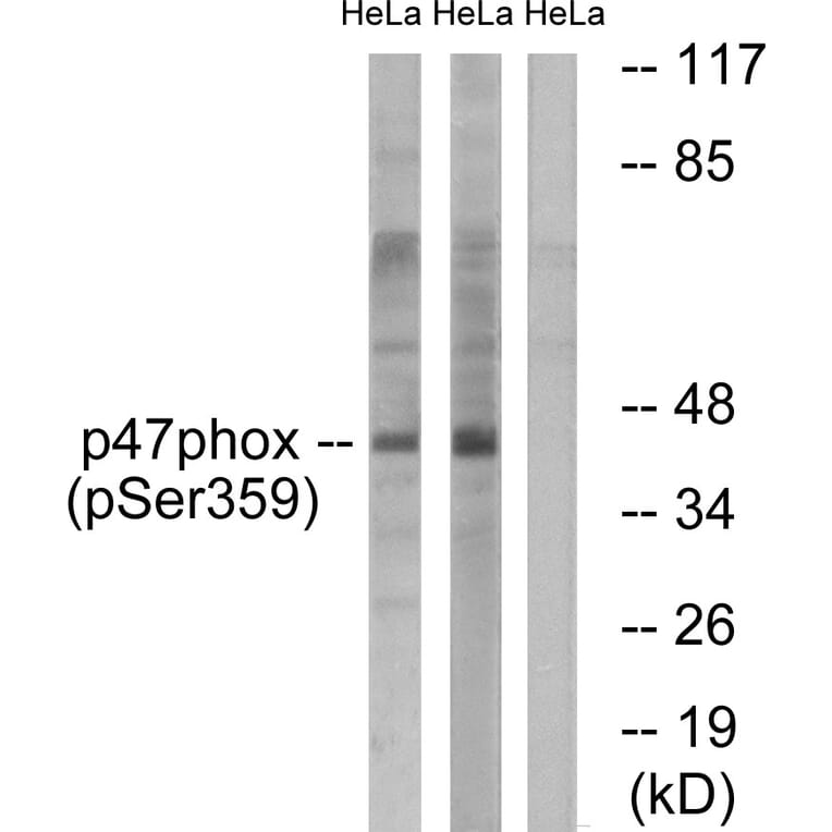 Western Blot - Anti-p47 phox (phospho Ser359) Antibody (A1172) - Antibodies.com