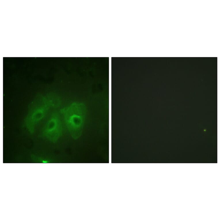 Immunofluorescence - Anti-p47 phox (phospho Ser359) Antibody (A1172) - Antibodies.com