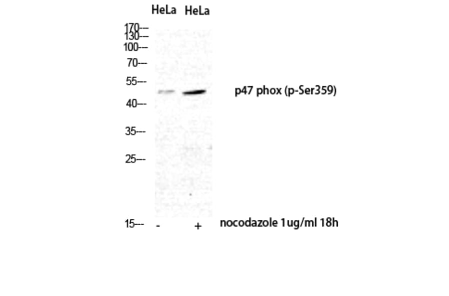 Western Blot - Anti-p47 phox (phospho Ser359) Antibody (A1172) - Antibodies.com