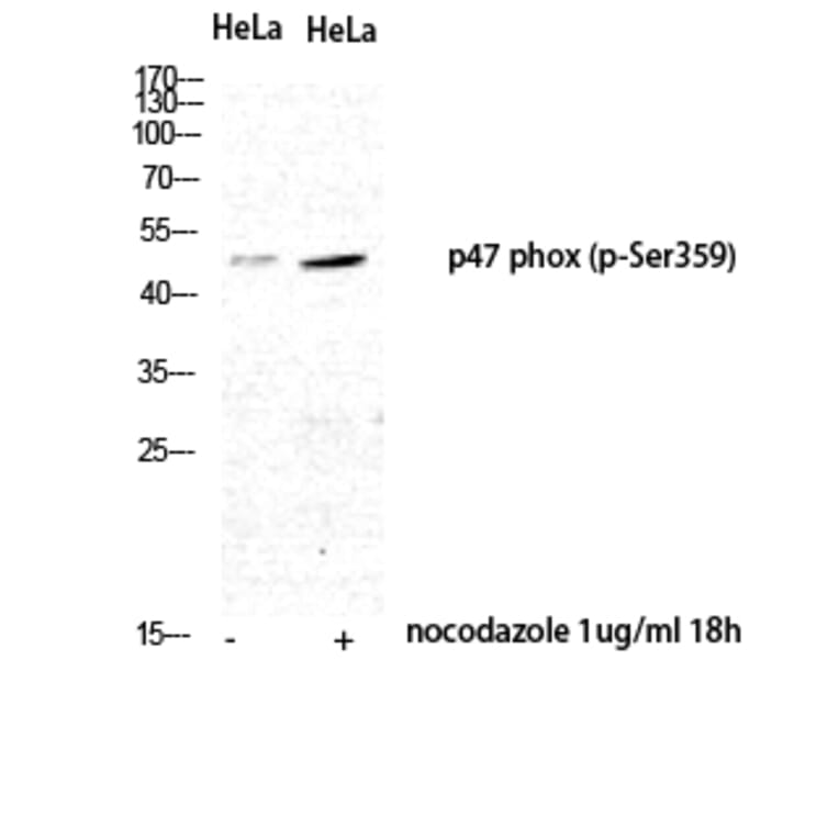 Western Blot - Anti-p47 phox (phospho Ser359) Antibody (A1172) - Antibodies.com
