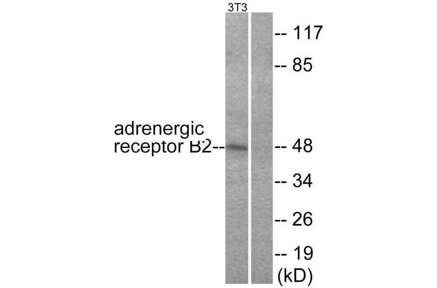 Western Blot - Anti-Adrenergic Receptor beta2 Antibody (B1131) - Antibodies.com