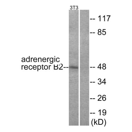 Western Blot - Anti-Adrenergic Receptor beta2 Antibody (B1131) - Antibodies.com