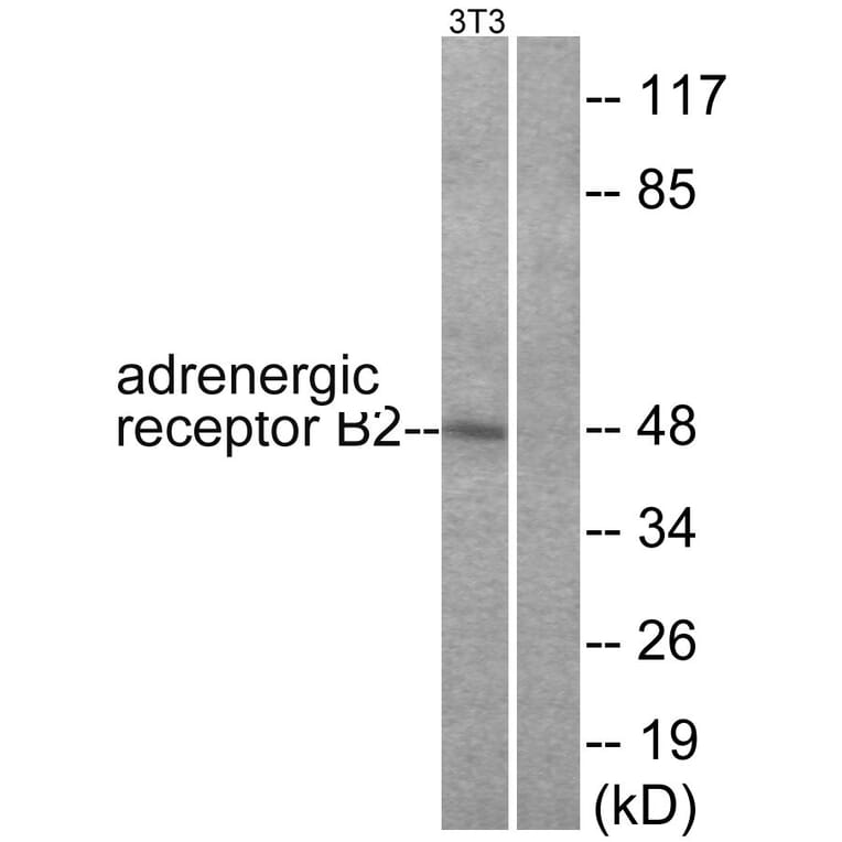 Western Blot - Anti-Adrenergic Receptor beta2 Antibody (B1131) - Antibodies.com