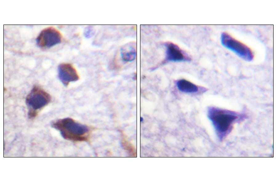 Immunohistochemistry - Anti-Adrenergic Receptor beta2 Antibody (B1131) - Antibodies.com