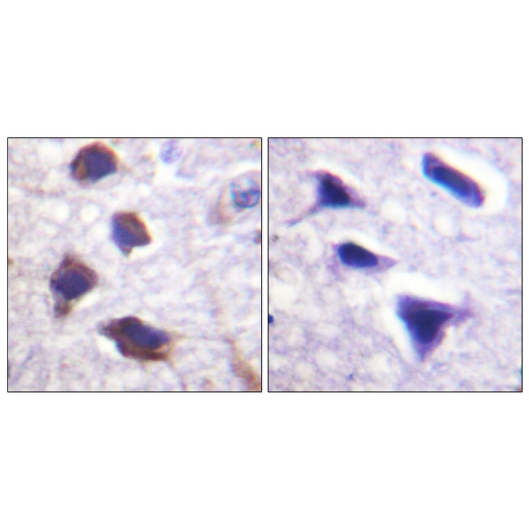 Immunohistochemistry - Anti-Adrenergic Receptor beta2 Antibody (B1131) - Antibodies.com