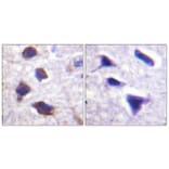 Immunohistochemistry - Anti-Adrenergic Receptor beta2 Antibody (B1131) - Antibodies.com