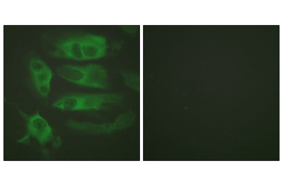 Immunofluorescence - Anti-Adrenergic Receptor beta2 Antibody (B1131) - Antibodies.com