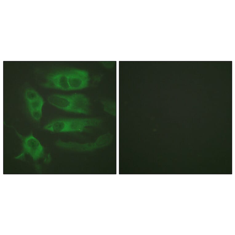 Immunofluorescence - Anti-Adrenergic Receptor beta2 Antibody (B1131) - Antibodies.com