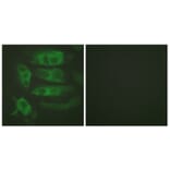 Immunofluorescence - Anti-Adrenergic Receptor beta2 Antibody (B1131) - Antibodies.com