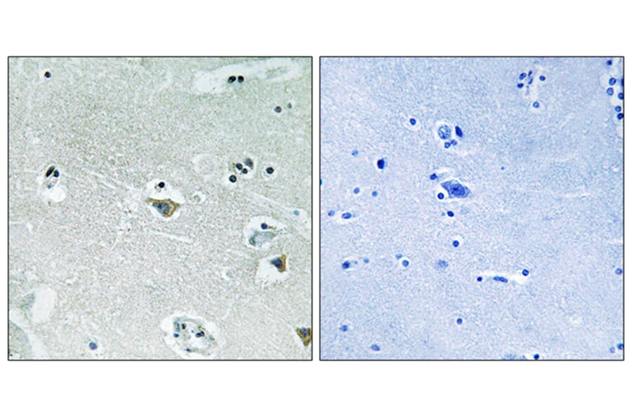 Immunohistochemistry - Anti-SREBP-1 (phospho Ser439) Antibody (A8425) - Antibodies.com