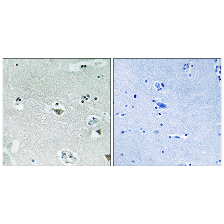 Immunohistochemistry - Anti-SREBP-1 (phospho Ser439) Antibody (A8425) - Antibodies.com
