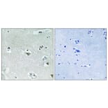 Immunohistochemistry - Anti-SREBP-1 (phospho Ser439) Antibody (A8425) - Antibodies.com