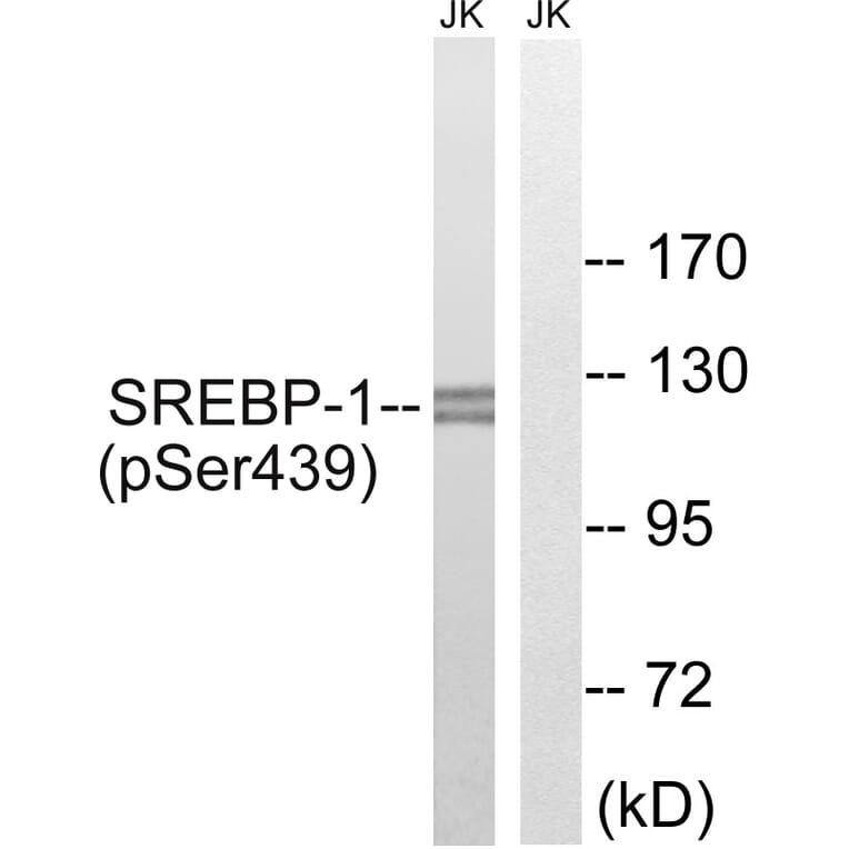 Western Blot - Anti-SREBP-1 (phospho Ser439) Antibody (A8425) - Antibodies.com