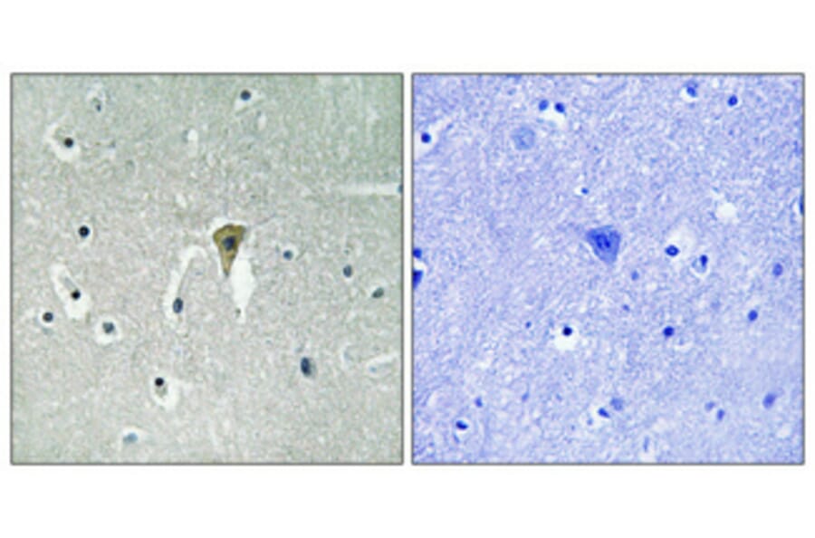 Immunohistochemistry - Anti-Kir6.2 (phospho Thr224) Antibody (A1084) - Antibodies.com