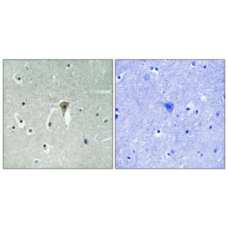 Immunohistochemistry - Anti-Kir6.2 (phospho Thr224) Antibody (A1084) - Antibodies.com