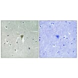 Immunohistochemistry - Anti-Kir6.2 (phospho Thr224) Antibody (A1084) - Antibodies.com