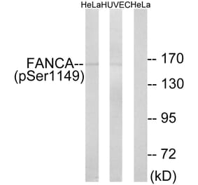 Western Blot - Anti-FANCA (phospho Ser1149) Antibody (A1148) - Antibodies.com