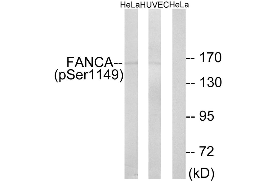 Western Blot - Anti-FANCA (phospho Ser1149) Antibody (A1148) - Antibodies.com