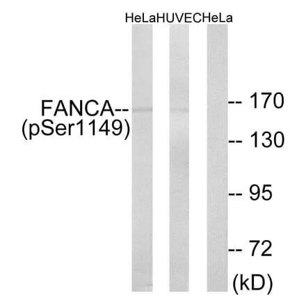 Western Blot - Anti-FANCA (phospho Ser1149) Antibody (A1148) - Antibodies.com