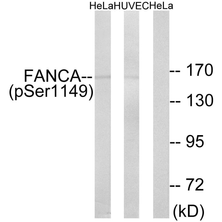 Western Blot - Anti-FANCA (phospho Ser1149) Antibody (A1148) - Antibodies.com