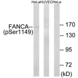 Western Blot - Anti-FANCA (phospho Ser1149) Antibody (A1148) - Antibodies.com