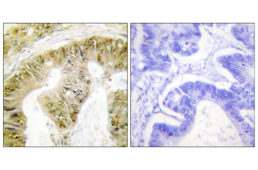 Immunohistochemistry - Anti-FANCA (phospho Ser1149) Antibody (A1148) - Antibodies.com