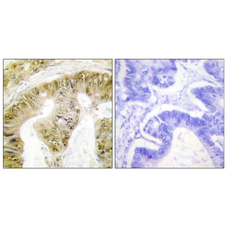 Immunohistochemistry - Anti-FANCA (phospho Ser1149) Antibody (A1148) - Antibodies.com